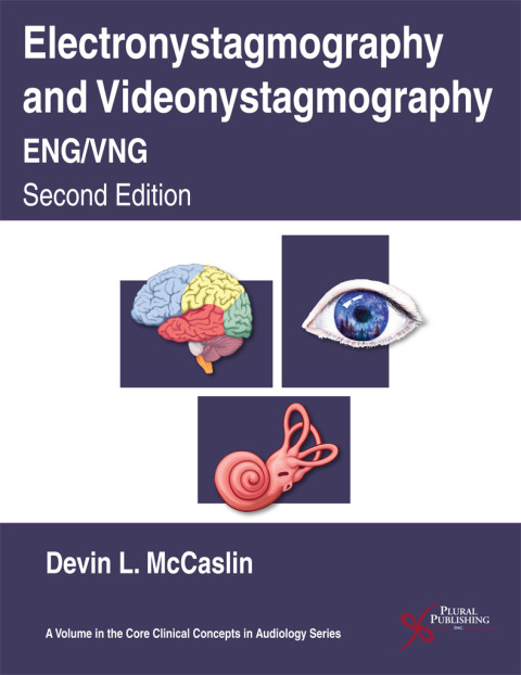 Electronystagmography/Videonystagmography (ENG/VNG), Second Edition 