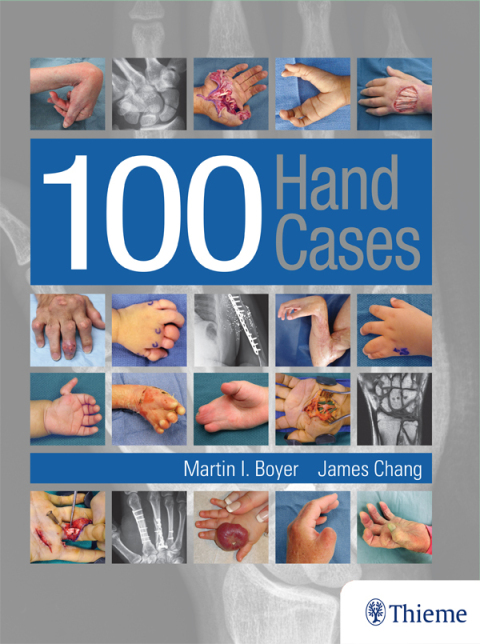 Cover image for book 100 Hand Cases