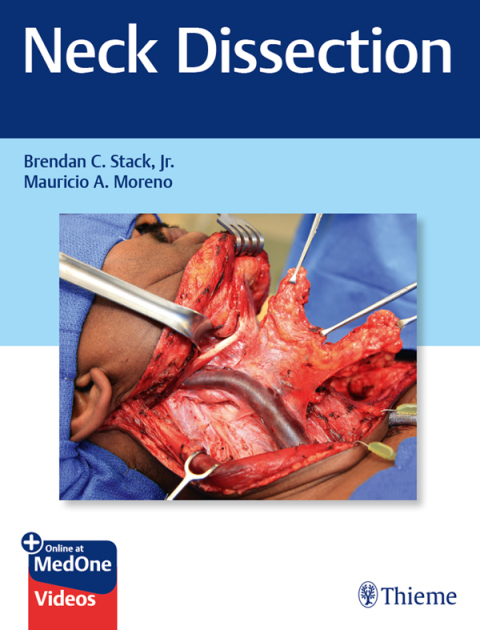 Cover image for book Neck Dissection