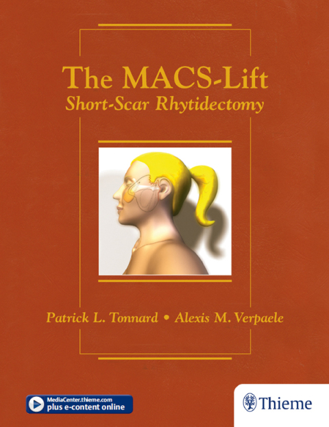 Cover image for book The MACS-Lift