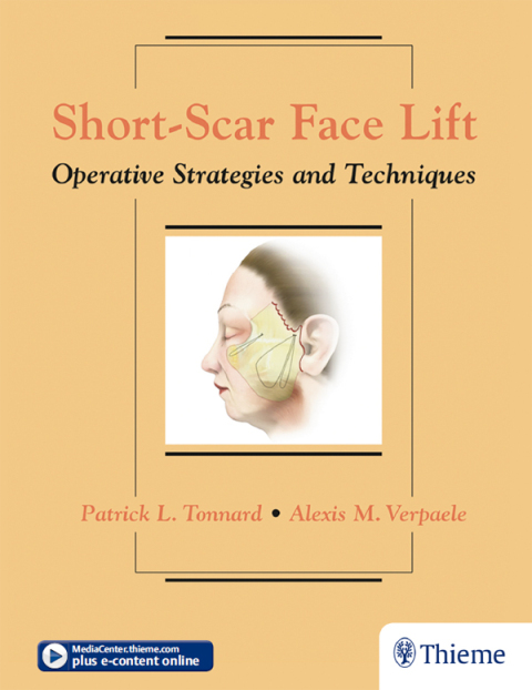 Cover image for book Short-Scar Face Lift
