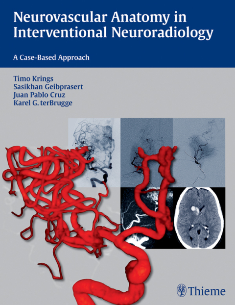 Cover image for book Neurovascular Anatomy in Interventional Neuroradiology