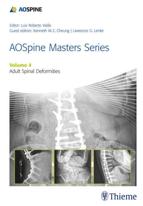 Cover image for book AOSpine Masters Series, Volume 4: Adult Spinal Deformities
