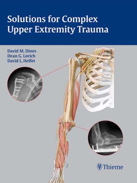 Solutions for Complex Upper Extremity Trauma 