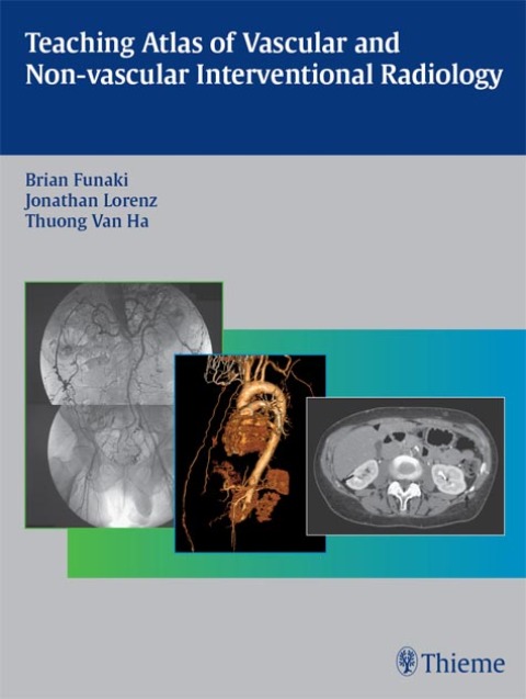 Teaching Atlas of Vascular and Non-vascular Interventional Radiology 