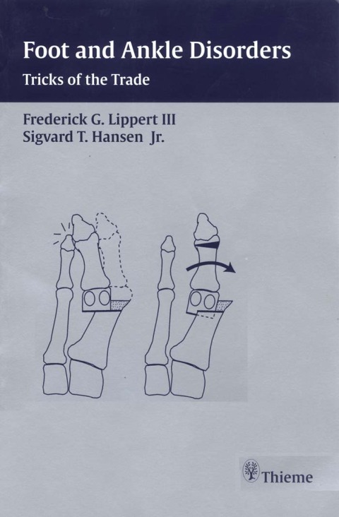Cover image for book Foot and Ankle Disorders