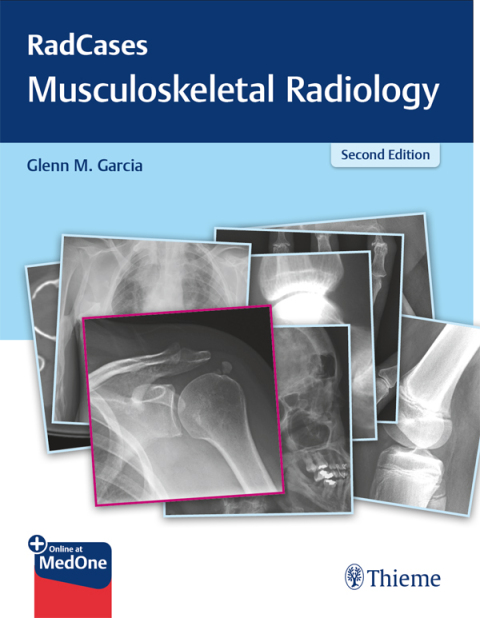 RadCases Q\u0026A Musculoskeletal Radiology 