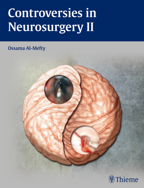 Cover image for book Controversies in Neurosurgery II