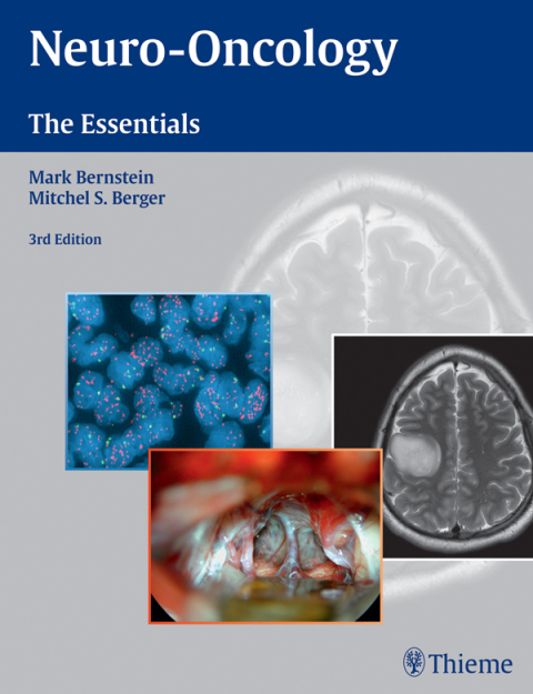 Cover image for book Neuro-Oncology: The Essentials