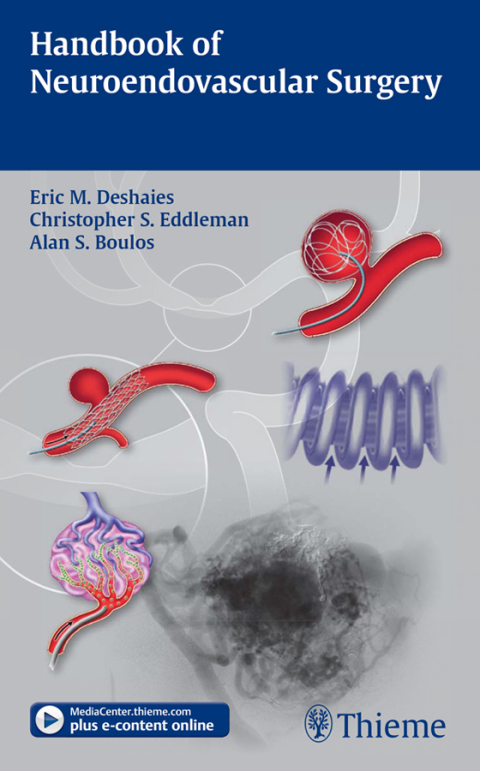Handbook of Neuroendovascular Surgery 