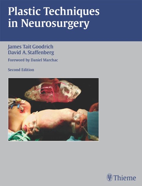 Plastic Techniques in Neurosurgery 