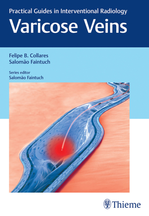 Cover image for book Varicose Veins