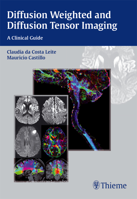 Cover image for book Diffusion Weighted and Diffusion Tensor Imaging