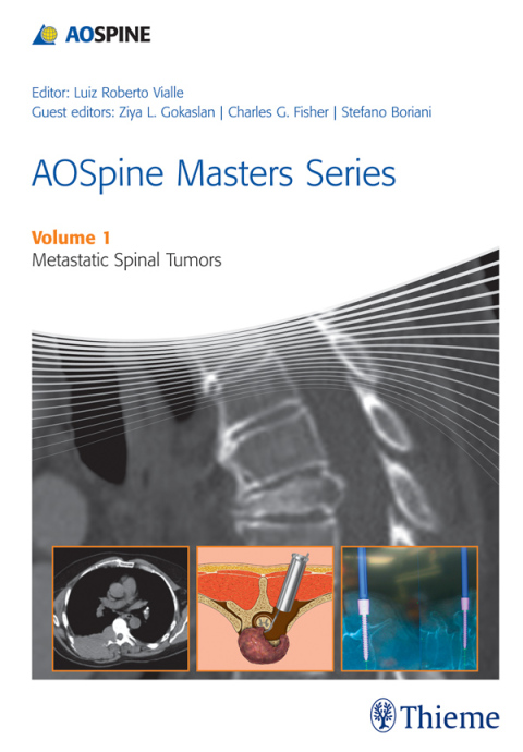 Cover image for book AOSpine Masters Series, Volume 1: Metastatic Spinal Tumors