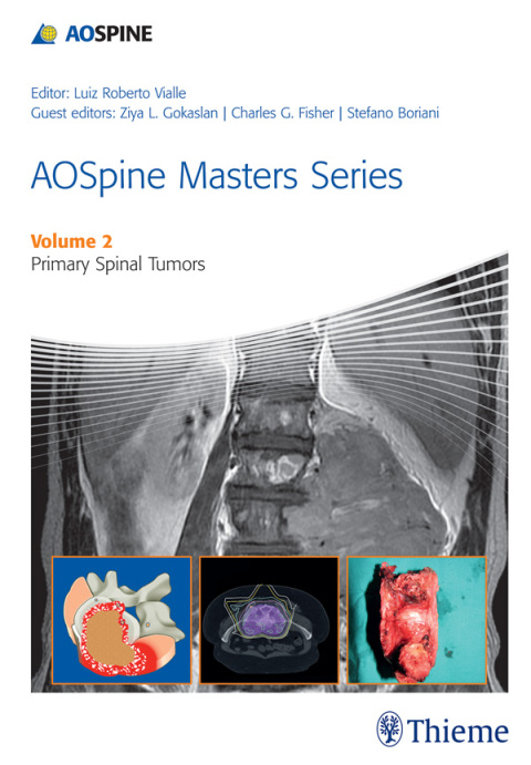 Cover image for book AOSpine Masters Series, Volume 2: Primary Spinal Tumors