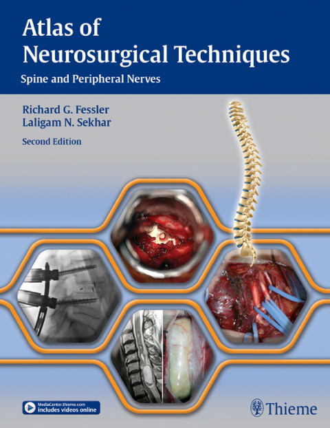 Cover image for book Atlas of Neurosurgical Techniques