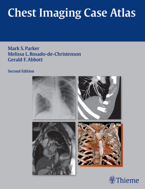 Cover image for book Chest Imaging Case Atlas