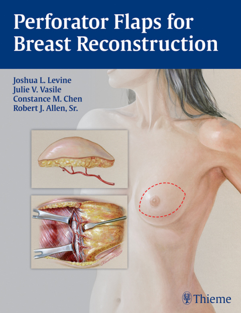 Cover image for book Perforator Flaps for Breast Reconstruction