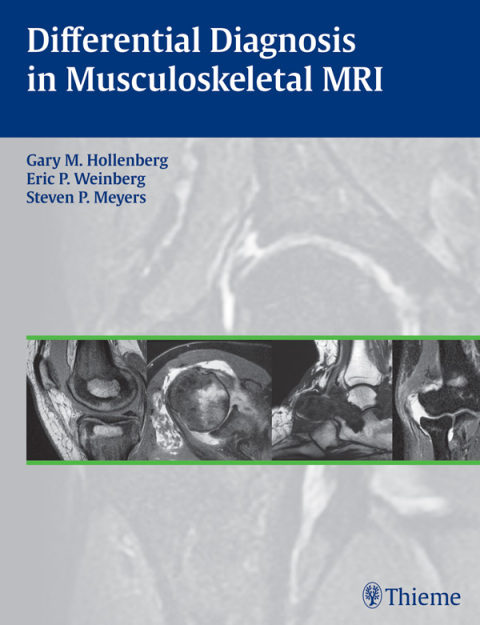 Differential Diagnosis in Musculoskeletal MRI 