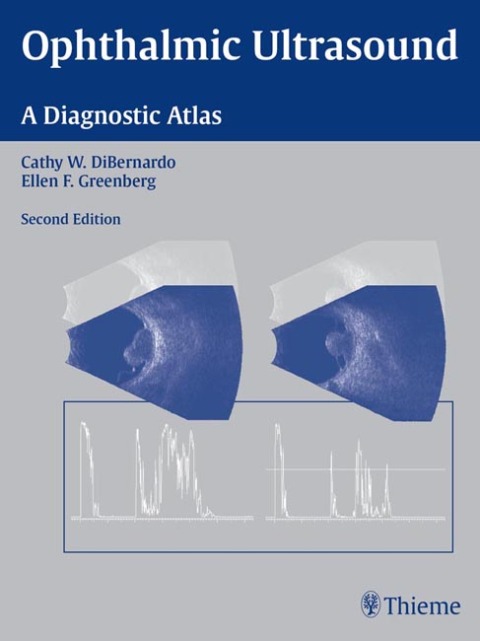 Cover image for book Ophthalmic Ultrasound