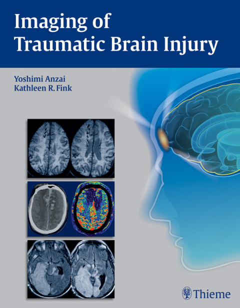 Cover image for book Imaging of Traumatic Brain Injury