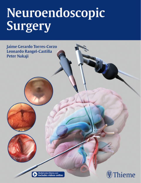 Neuroendoscopic Surgery 