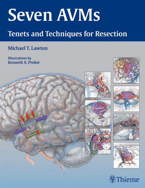 Cover image for book Seven AVMs