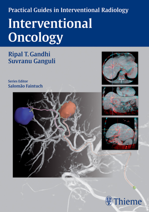 Cover image for book Interventional Oncology