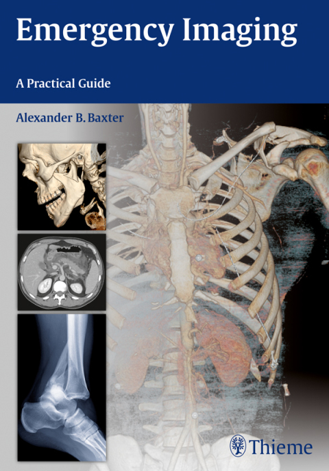 Cover image for book Emergency Imaging