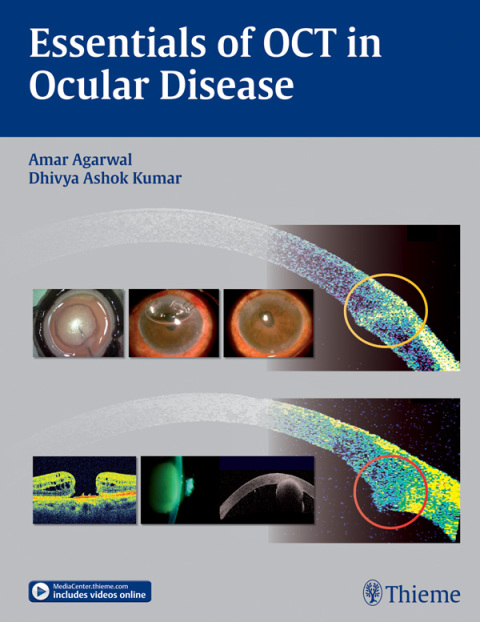 Essentials of OCT in Ocular Disease 