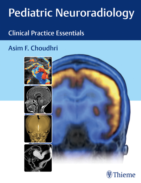 Cover image for book Pediatric Neuroradiology