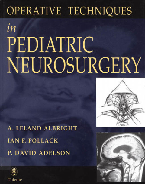 Operative Techniques in Pediatric Neurosurgery 