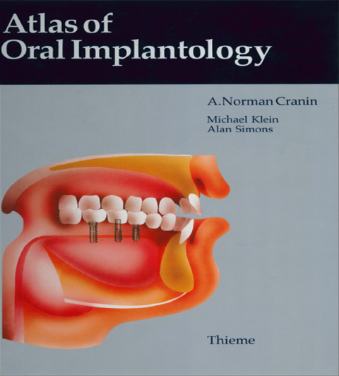 Atlas of Oral Implantology 