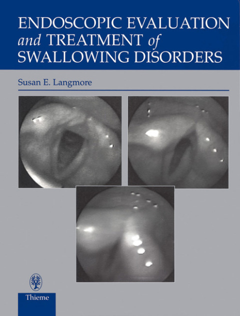 Cover image for book Endoscopic Evaluation and Treatment of Swallowing Disorders