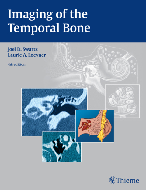 Cover image for book Imaging of the Temporal Bone