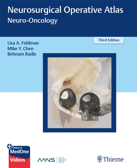 Neurosurgical Operative Atlas: Neuro-Oncology 