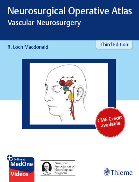 Cover image for book Neurosurgical Operative Atlas: Vascular Neurosurgery