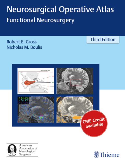 Neurosurgical Operative Atlas 