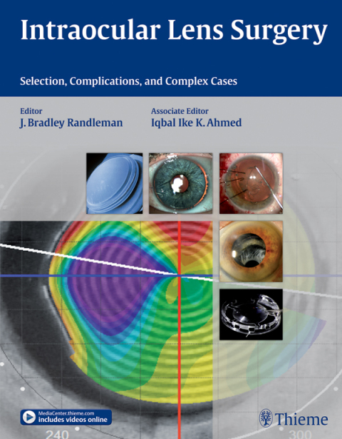 Cover image for book Intraocular Lens Surgery