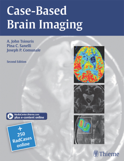 Cover image for book Case-Based Brain Imaging