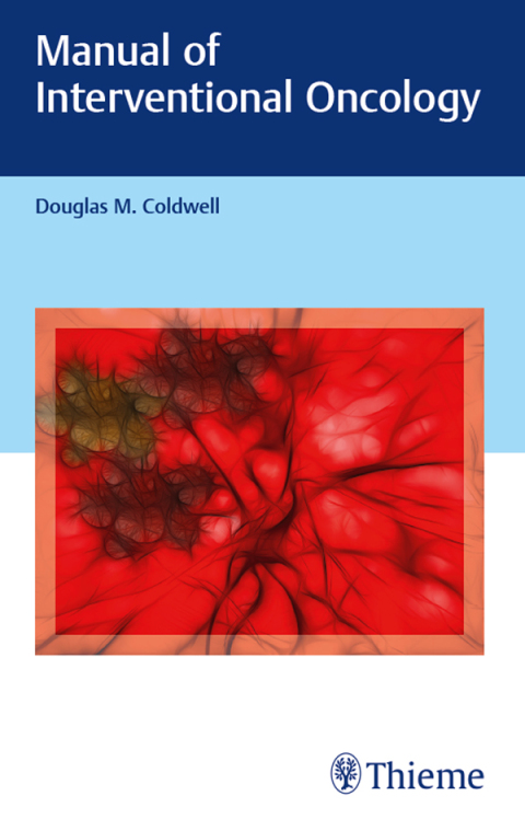 Cover image for book Manual of Interventional Oncology