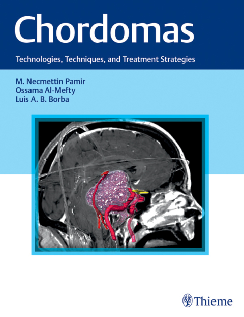 Cover image for book Chordomas