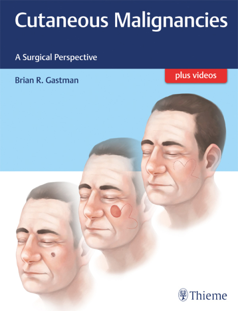 Cover image for book Cutaneous Malignancies