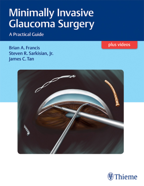 Cover image for book Minimally Invasive Glaucoma Surgery