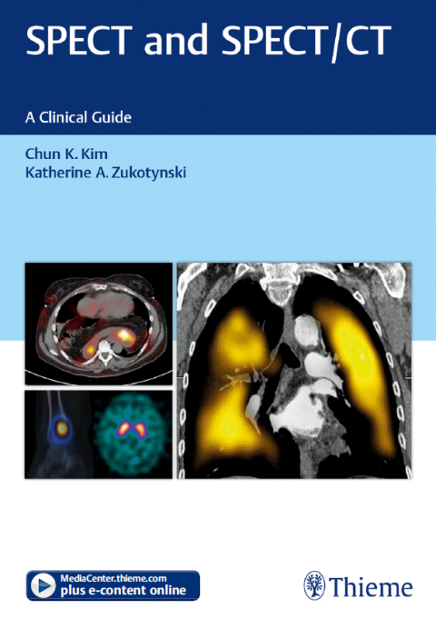 Cover image for book SPECT and SPECT/CT