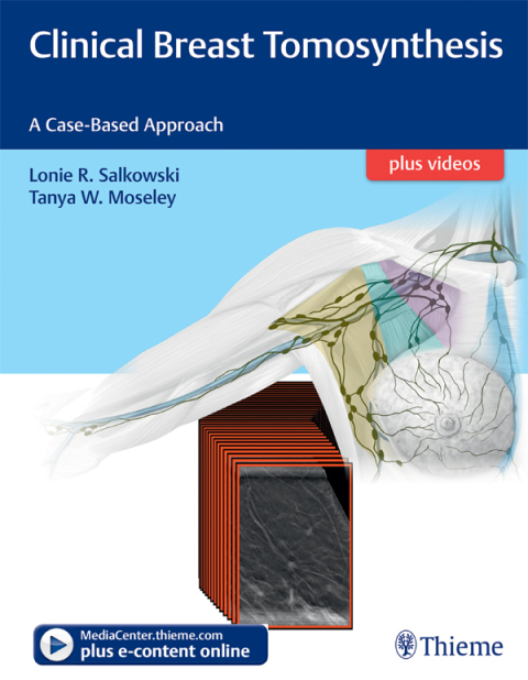 Cover image for book Clinical Breast Tomosynthesis