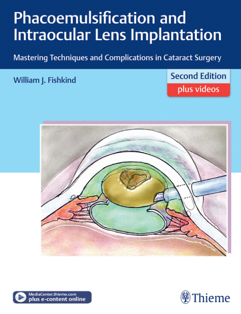 Cover image for book Phacoemulsification and Intraocular Lens Implantation
