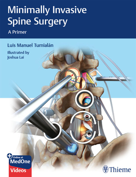 Cover image for book Minimally Invasive Spine Surgery