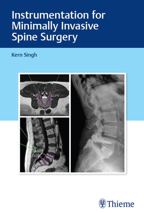 Instrumentation for Minimally Invasive Spine Surgery 