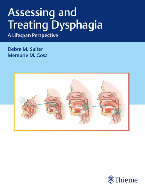 Cover image for book Assessing and Treating Dysphagia